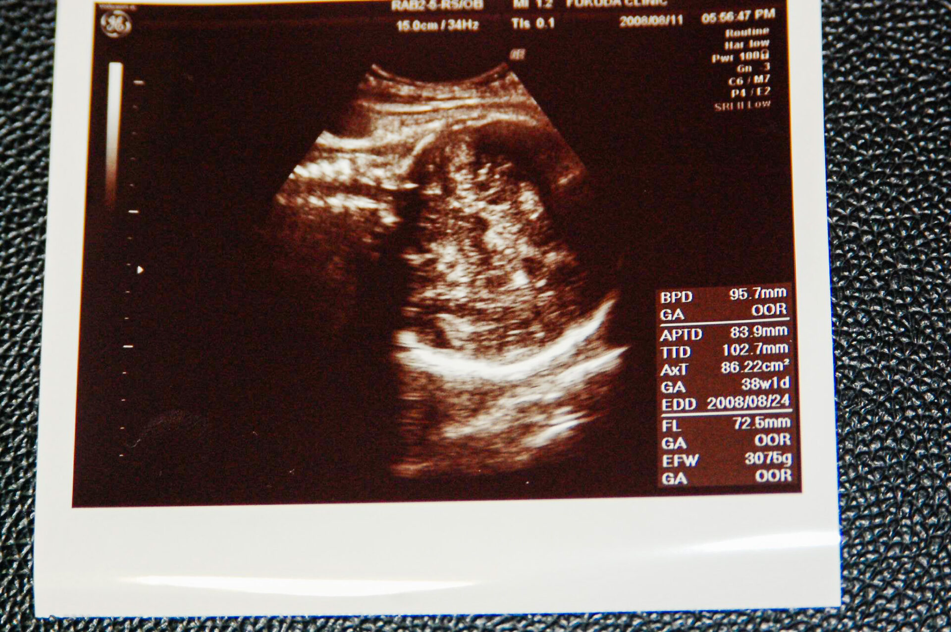 ultrasonography